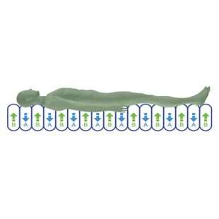 VARIABLE PRESSURE MATTRESS FOR THE PREVENTION AND TREATMENT OF BEDSORES T01