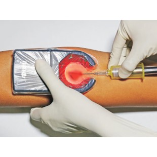 VEINSPY HAND-HELD VEIN FINDER