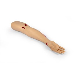 TRAUMA TINA – HAND WITH HEAVILY BLEEDING WOUNDS TRAUMA TINA – HAND WITH HEAVILY BLEEDING WOUNDS