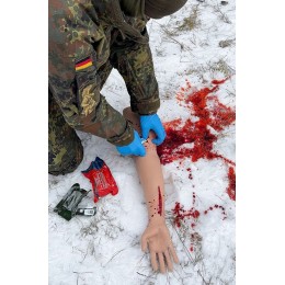 TRAUMA TINA – HAND WITH HEAVILY BLEEDING WOUNDS TRAUMA TINA – HAND WITH HEAVILY BLEEDING WOUNDS