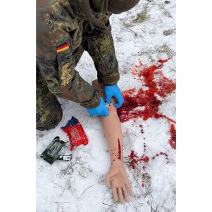 „TRAUMA TINA“ – RANKA SU STIPRIAI KRAUJUOJANČIOMIS ŽAIZDOMIS „TRAUMA TINA“ – RANKA SU STIPRIAI KRAUJUOJANČIOMIS ŽAIZDOMIS