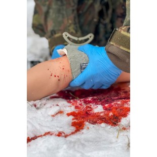 „TRAUMA TINA“ – RANKA SU STIPRIAI KRAUJUOJANČIOMIS ŽAIZDOMIS „TRAUMA TINA“ – RANKA SU STIPRIAI KRAUJUOJANČIOMIS ŽAIZDOMIS