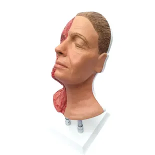 HEAD FOR FACIAL INJECTIONS WITH MUSCLES, ARTERIES AND NERVES
